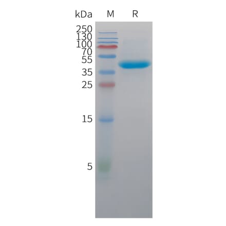 SDS-PAGE - Recombinant Cynomolgus macaque Nectin-4 Protein (10xHis Tag) (A324917) - Antibodies.com