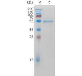 SDS-PAGE - Recombinant Cynomolgus macaque ROR2 Protein (10xHis Tag) (A324918) - Antibodies.com