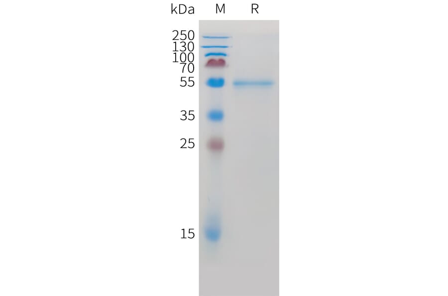 SDS-PAGE - Recombinant Cynomolgus macaque ROR2 Protein (10xHis Tag) (A324918) - Antibodies.com