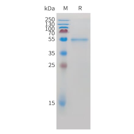 SDS-PAGE - Recombinant Cynomolgus macaque ROR2 Protein (10xHis Tag) (A324918) - Antibodies.com