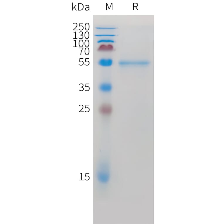 SDS-PAGE - Recombinant Cynomolgus macaque ROR2 Protein (10xHis Tag) (A324918) - Antibodies.com