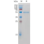 SDS-PAGE - Recombinant Cynomolgus macaque ROR2 Protein (10xHis Tag) (A324918) - Antibodies.com