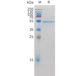 SDS-PAGE - Recombinant Cynomolgus macaque ROR2 Protein (10xHis Tag) (A324919) - Antibodies.com