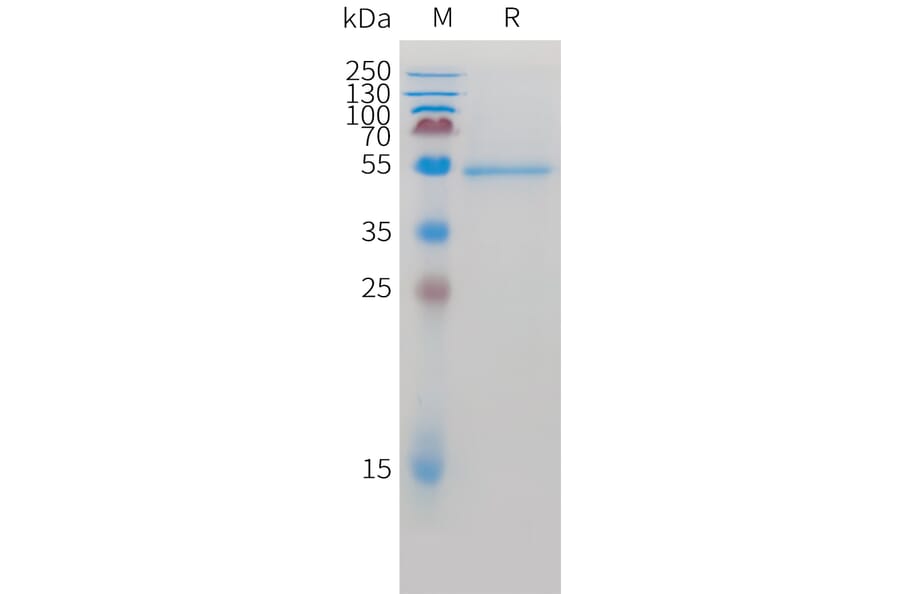 SDS-PAGE - Recombinant Cynomolgus macaque ROR2 Protein (10xHis Tag) (A324919) - Antibodies.com