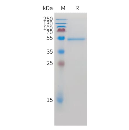 SDS-PAGE - Recombinant Cynomolgus macaque ROR2 Protein (10xHis Tag) (A324919) - Antibodies.com