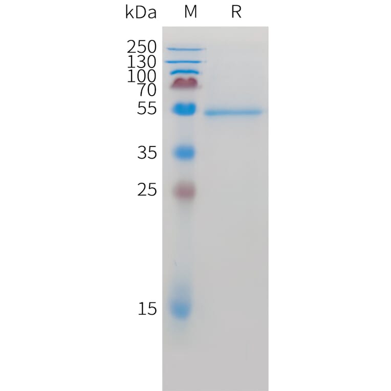 SDS-PAGE - Recombinant Cynomolgus macaque ROR2 Protein (10xHis Tag) (A324919) - Antibodies.com