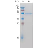 SDS-PAGE - Recombinant Cynomolgus macaque ROR2 Protein (10xHis Tag) (A324919) - Antibodies.com