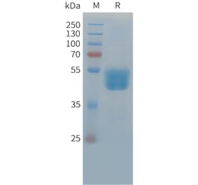 SDS-PAGE - Recombinant Cynomolgus macaque TIGIT Protein (Fc Tag) (A324920) - Antibodies.com