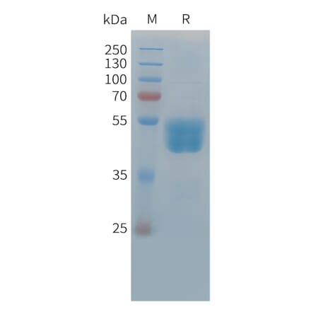 SDS-PAGE - Recombinant Cynomolgus macaque TIGIT Protein (Fc Tag) (A324920) - Antibodies.com
