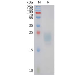 SDS-PAGE - Recombinant Feline IL-31 Protein (6xHis Tag) (A324922) - Antibodies.com
