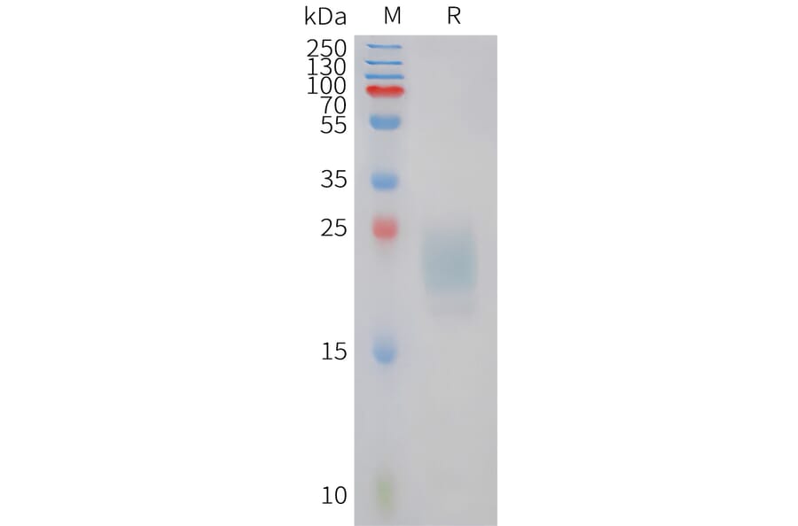 SDS-PAGE - Recombinant Feline IL-31 Protein (6xHis Tag) (A324922) - Antibodies.com