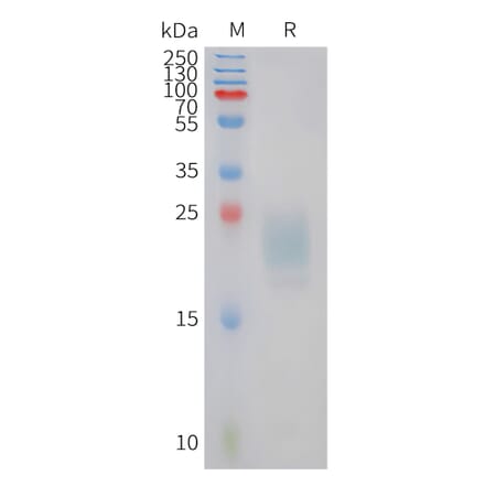 SDS-PAGE - Recombinant Feline IL-31 Protein (6xHis Tag) (A324922) - Antibodies.com