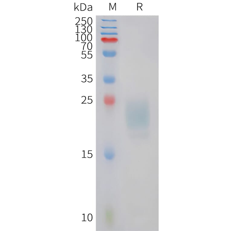 SDS-PAGE - Recombinant Feline IL-31 Protein (6xHis Tag) (A324922) - Antibodies.com