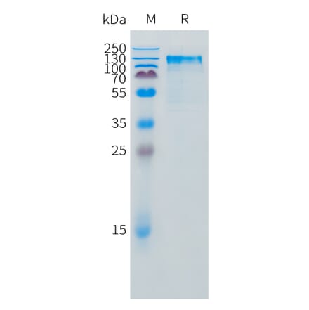 SDS-PAGE - Recombinant Feline IL-31RA Protein (Fc Tag) (A324923) - Antibodies.com