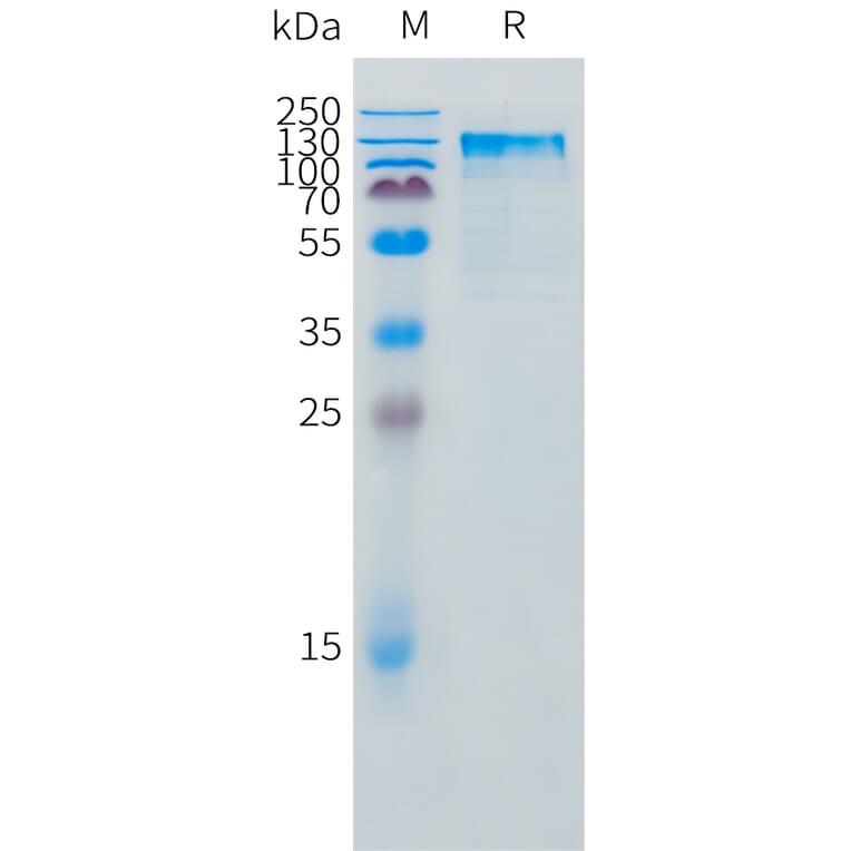 SDS-PAGE - Recombinant Feline IL-31RA Protein (Fc Tag) (A324923) - Antibodies.com