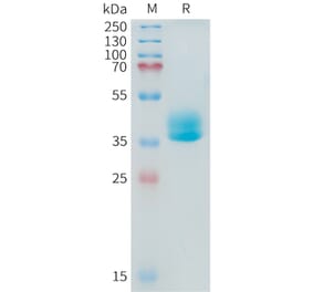 SDS-PAGE - Recombinant Human ADAM17 Protein (Fc Tag) (A324924) - Antibodies.com