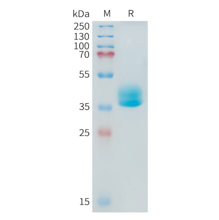 SDS-PAGE - Recombinant Human ADAM17 Protein (Fc Tag) (A324924) - Antibodies.com