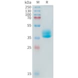 SDS-PAGE - Recombinant Human ADAM17 Protein (Fc Tag) (A324924) - Antibodies.com