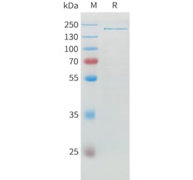 SDS-PAGE - Recombinant Human ADAMTS13 Protein (6xHis Tag) (A324925) - Antibodies.com