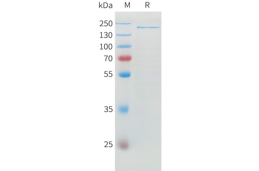 SDS-PAGE - Recombinant Human ADAMTS13 Protein (6xHis Tag) (A324925) - Antibodies.com