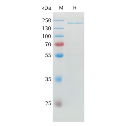 SDS-PAGE - Recombinant Human ADAMTS13 Protein (6xHis Tag) (A324925) - Antibodies.com