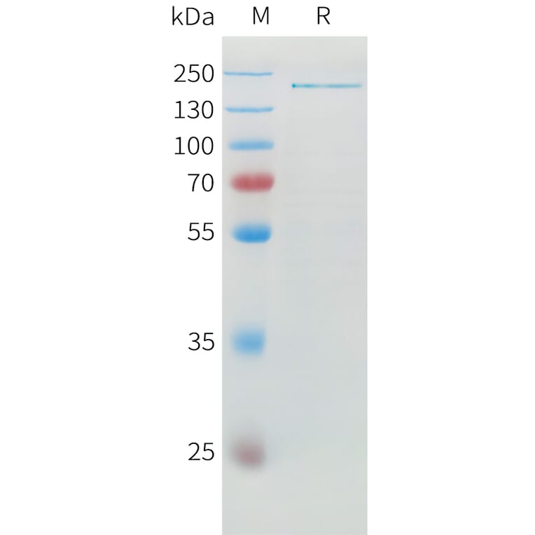 SDS-PAGE - Recombinant Human ADAMTS13 Protein (6xHis Tag) (A324925) - Antibodies.com