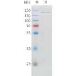 SDS-PAGE - Recombinant Human ADAMTS13 Protein (6xHis Tag) (A324925) - Antibodies.com