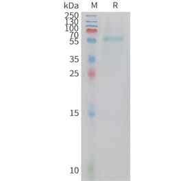 SDS-PAGE - Recombinant Human Adiponectin Protein (Fc Tag) (A324926) - Antibodies.com