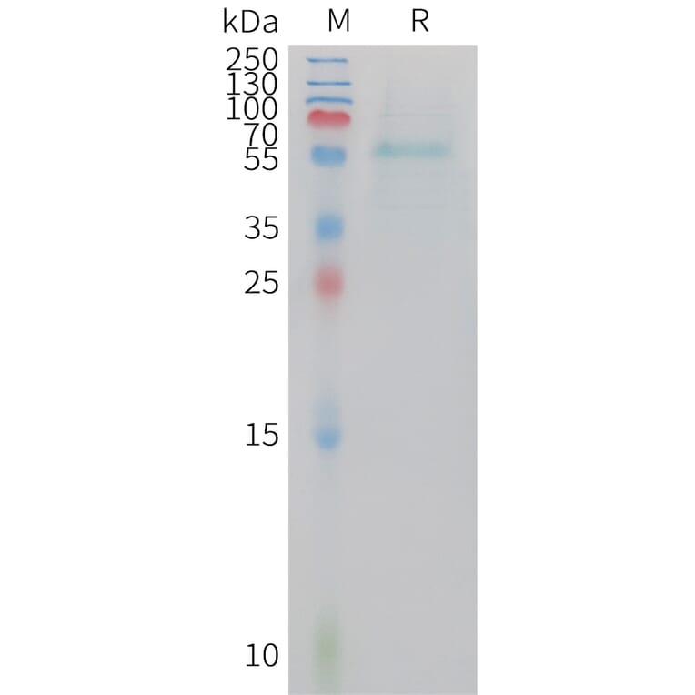 SDS-PAGE - Recombinant Human Adiponectin Protein (Fc Tag) (A324926) - Antibodies.com