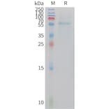 SDS-PAGE - Recombinant Human Adiponectin Protein (Fc Tag) (A324926) - Antibodies.com
