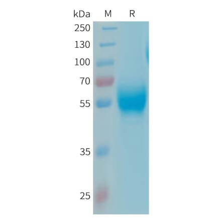 SDS-PAGE - Recombinant Human Apo-H Protein (6xHis Tag) (A324928) - Antibodies.com