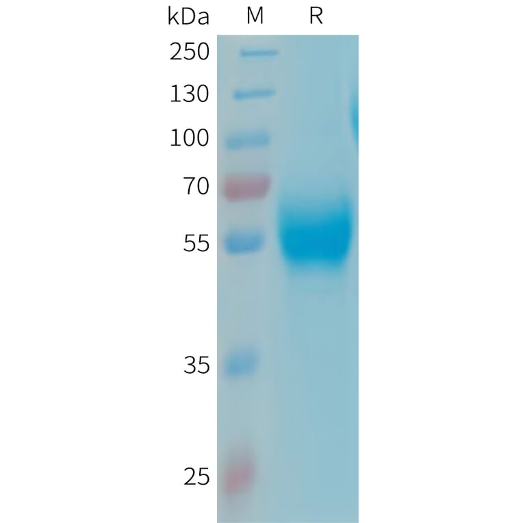 SDS-PAGE - Recombinant Human Apo-H Protein (6xHis Tag) (A324928) - Antibodies.com