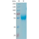 SDS-PAGE - Recombinant Human Apo-H Protein (6xHis Tag) (A324928) - Antibodies.com
