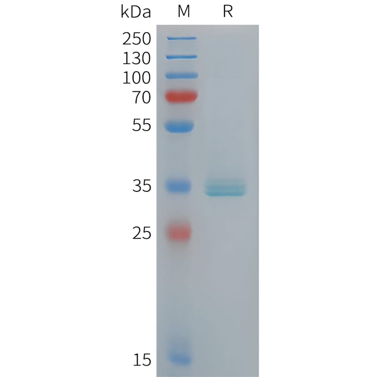 SDS-PAGE - Recombinant Human Apolipoprotein E Protein (6xHis Tag) (A324930) - Antibodies.com