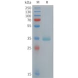 SDS-PAGE - Recombinant Human Apolipoprotein E Protein (6xHis Tag) (A324930) - Antibodies.com