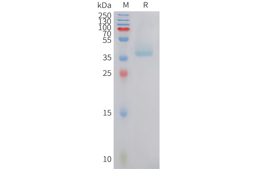 SDS-PAGE - Recombinant Human B2R Protein (Fc Tag) (A324931) - Antibodies.com