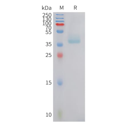 SDS-PAGE - Recombinant Human B2R Protein (Fc Tag) (A324931) - Antibodies.com