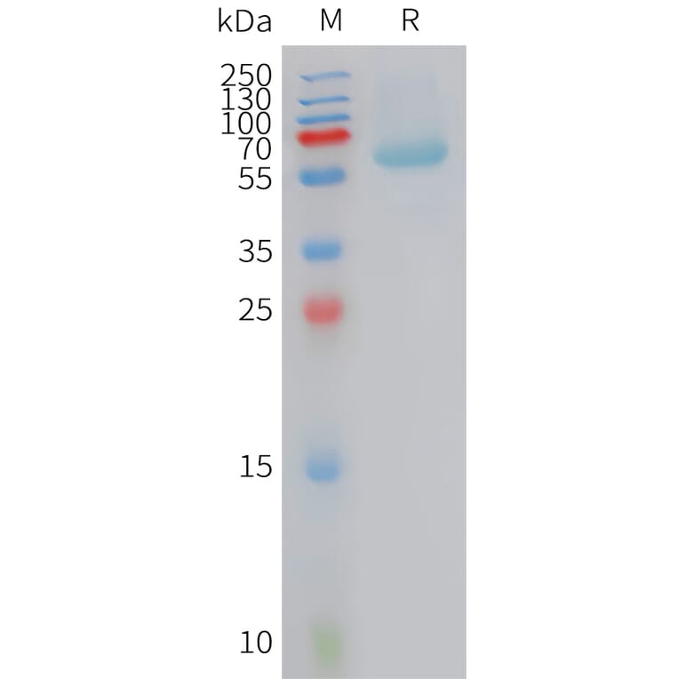 SDS-PAGE - Recombinant Human BAMBI/NMA Protein (Fc Tag) (A324932) - Antibodies.com