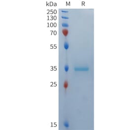 SDS-PAGE - Recombinant Human BCMA Protein (Fc Tag) (A324934) - Antibodies.com