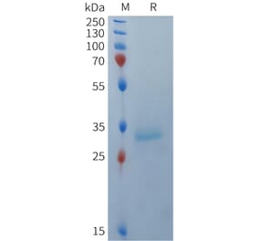 SDS-PAGE - Recombinant Human BCMA Protein (Fc Tag) (A324935) - Antibodies.com