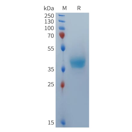 SDS-PAGE - Recombinant Human BCMA Protein (Fc Tag) (A324936) - Antibodies.com