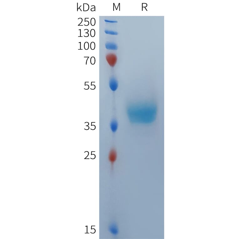 SDS-PAGE - Recombinant Human BCMA Protein (Fc Tag) (A324936) - Antibodies.com