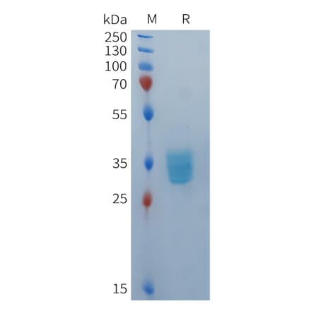 SDS-PAGE - Recombinant Human BCMA Protein (Fc Tag) (A324937) - Antibodies.com
