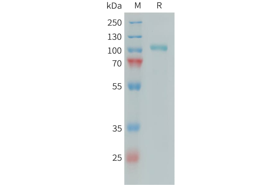 SDS-PAGE - Recombinant Human C1s Protein (6xHis Tag) (A324938) - Antibodies.com