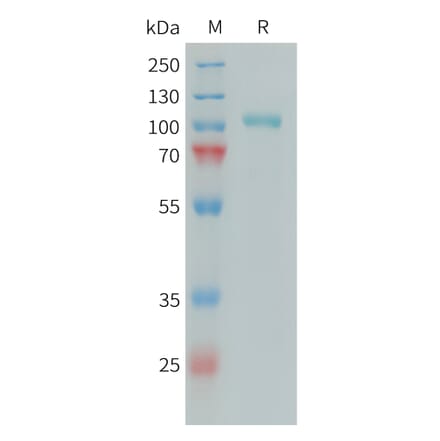 SDS-PAGE - Recombinant Human C1s Protein (6xHis Tag) (A324938) - Antibodies.com