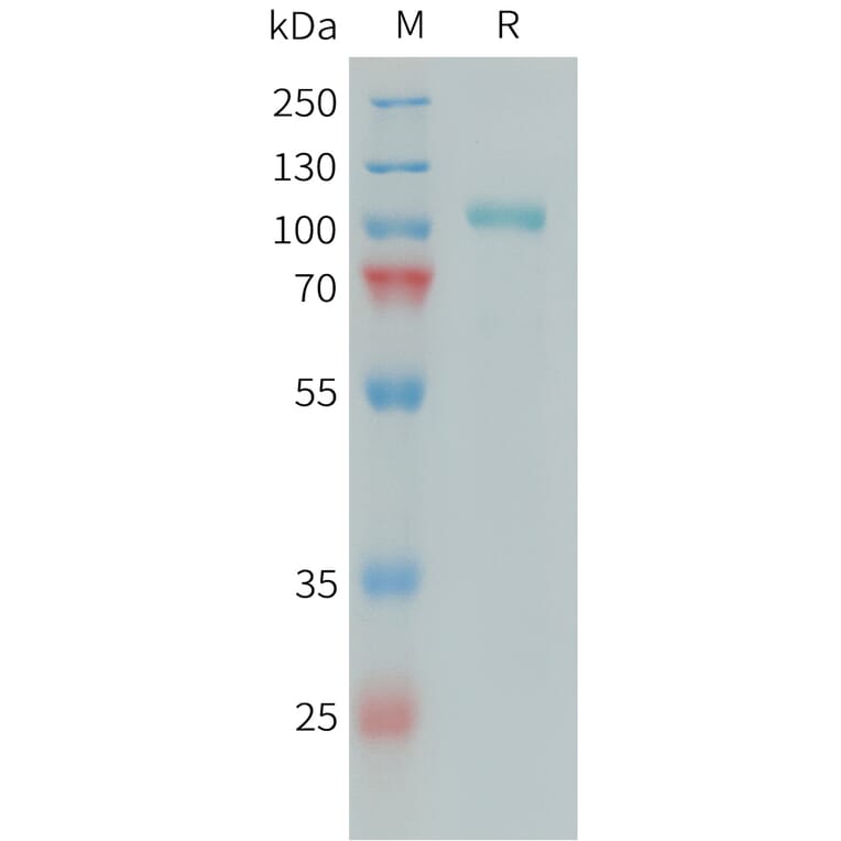 SDS-PAGE - Recombinant Human C1s Protein (6xHis Tag) (A324938) - Antibodies.com