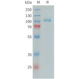 SDS-PAGE - Recombinant Human C1s Protein (6xHis Tag) (A324938) - Antibodies.com