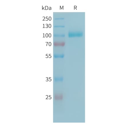 SDS-PAGE - Recombinant Human C2 Protein (6xHis Tag) (A324939) - Antibodies.com