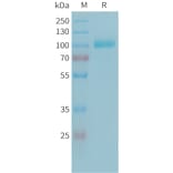 SDS-PAGE - Recombinant Human C2 Protein (6xHis Tag) (A324939) - Antibodies.com