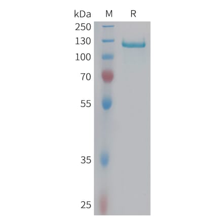 SDS-PAGE - Recombinant Human C6 Protein (6xHis Tag) (A324941) - Antibodies.com